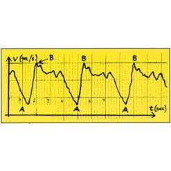 Swimsportec Schwimmgeschwindigkeits-Mess-System "Speedometer" 9 Swimsportec Schwimmgeschwindigkeits-Mess-System "Speedometer" -WasserWelt Verkäufe 223 6041 2
